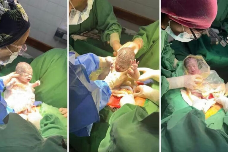 Nacieron trigemelas en Salta, un caso que sucede cada un millón